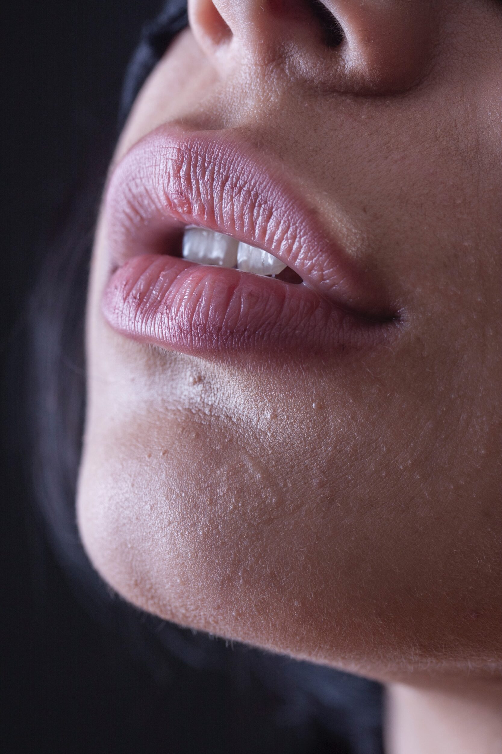 1740496210 LIP image picuture 1682744199