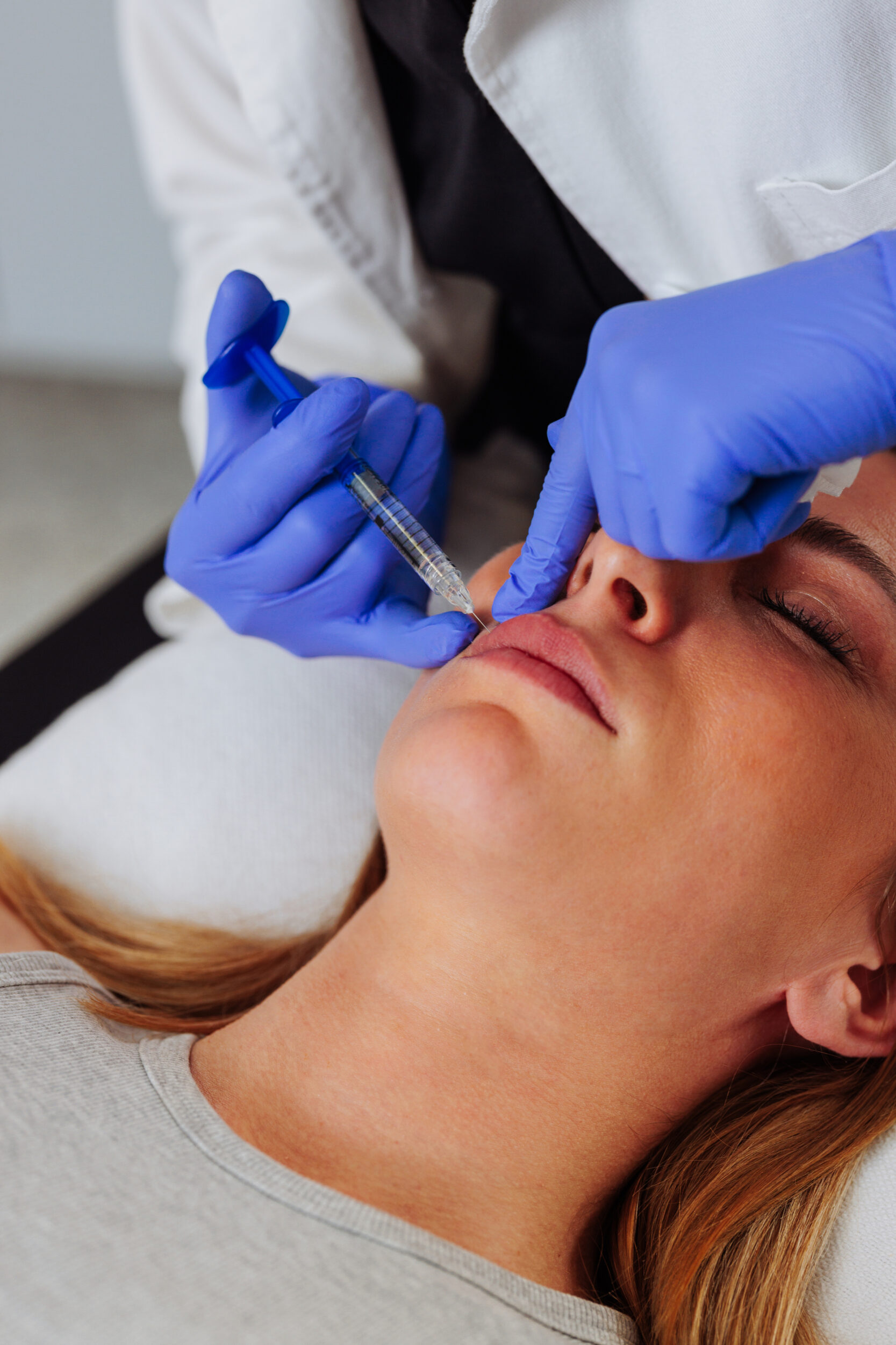 Cosmetic procedure of injecting facial filler
