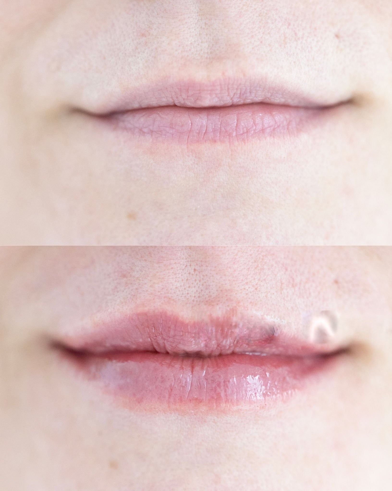 wmremove transformed