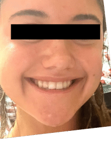 After Image: Lip Flip