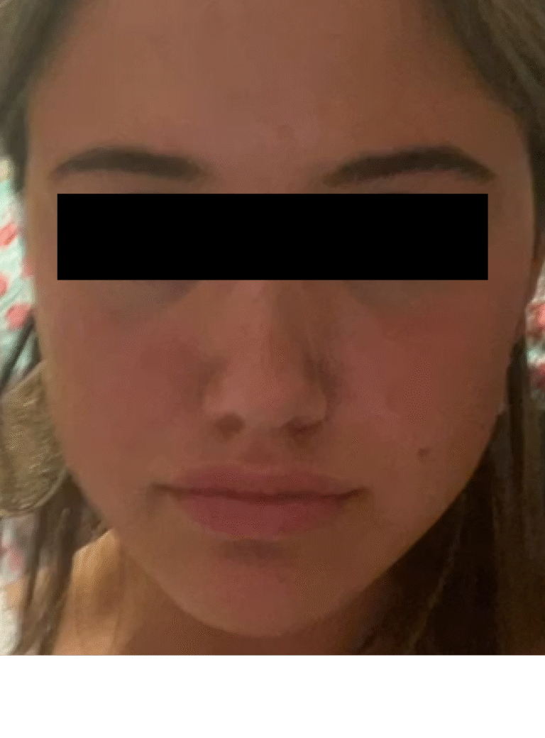After Image: Lip Flip - front